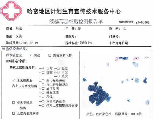 TCT檢測(cè)